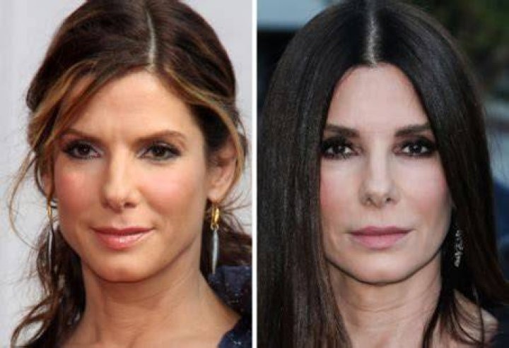 Did Sandra Bullock Get Plastic Surgery? Transformation Photos