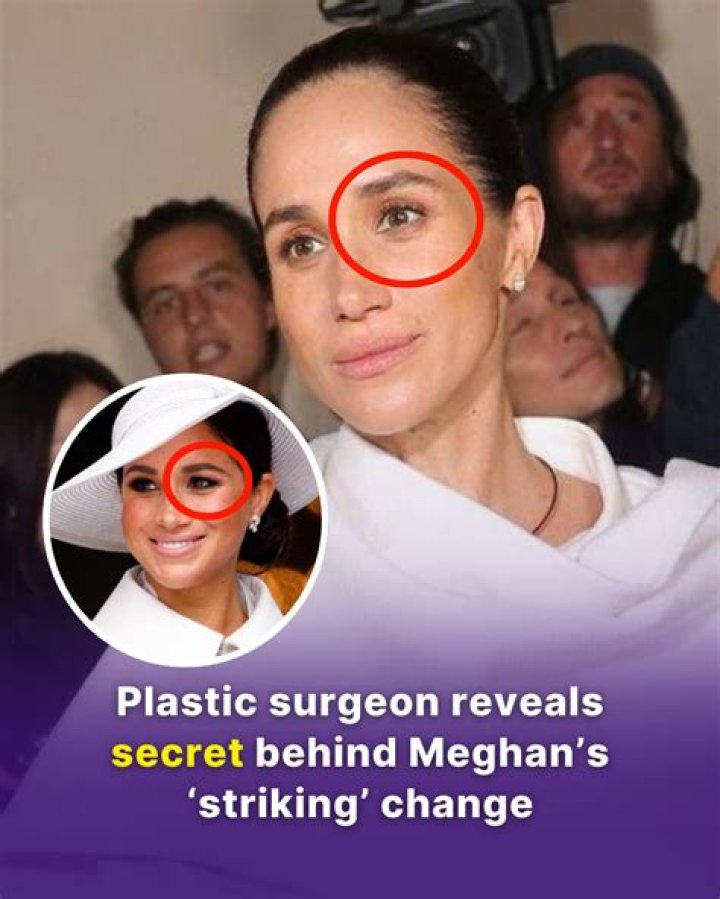 Plastic Surgeon Reveals the REAL TRUTH about Morpheus 8 YouTube