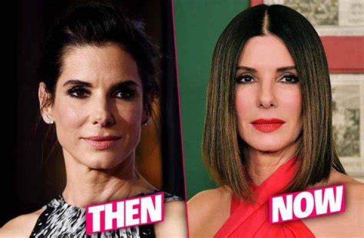 Sandra Bullock Plastic Surgery Rumors, Before and After