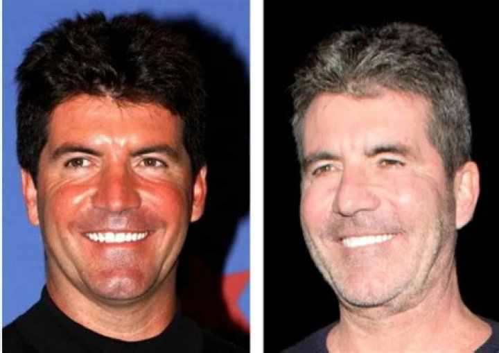 Understanding Simon Cowell's Journey As A Father Of A Disabled Son