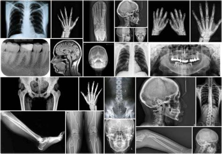 images/histmed/wwi/lab-07.jpg x-rays